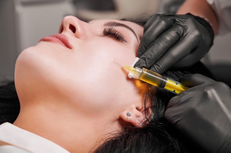 Recovery Tips After Your PRP Microneedling Session