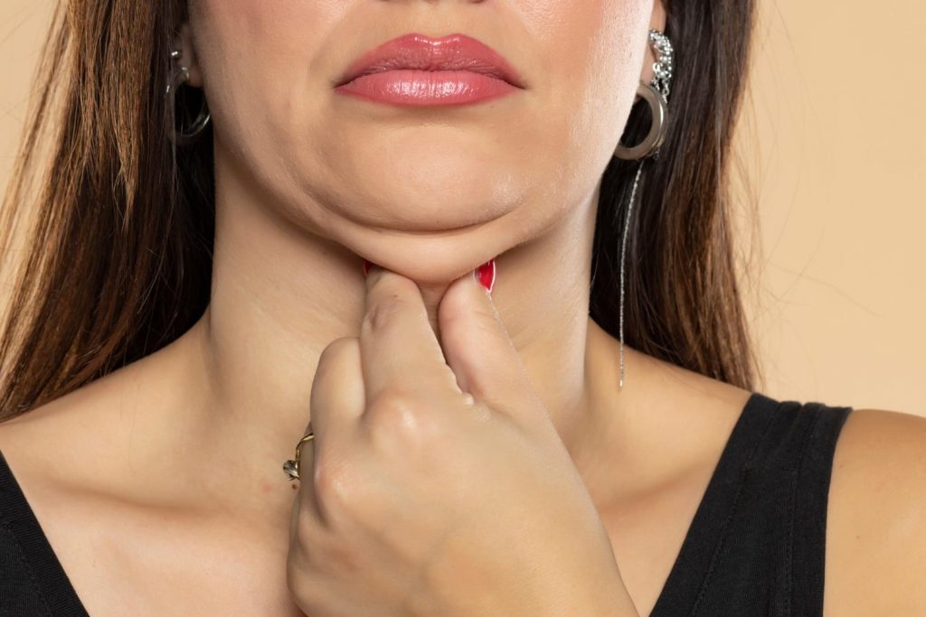 Is Your Double Chin Just Fat or Something Else?
