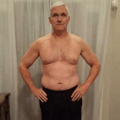 Shelby before treatment