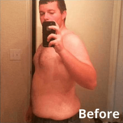 Marcus before treatment